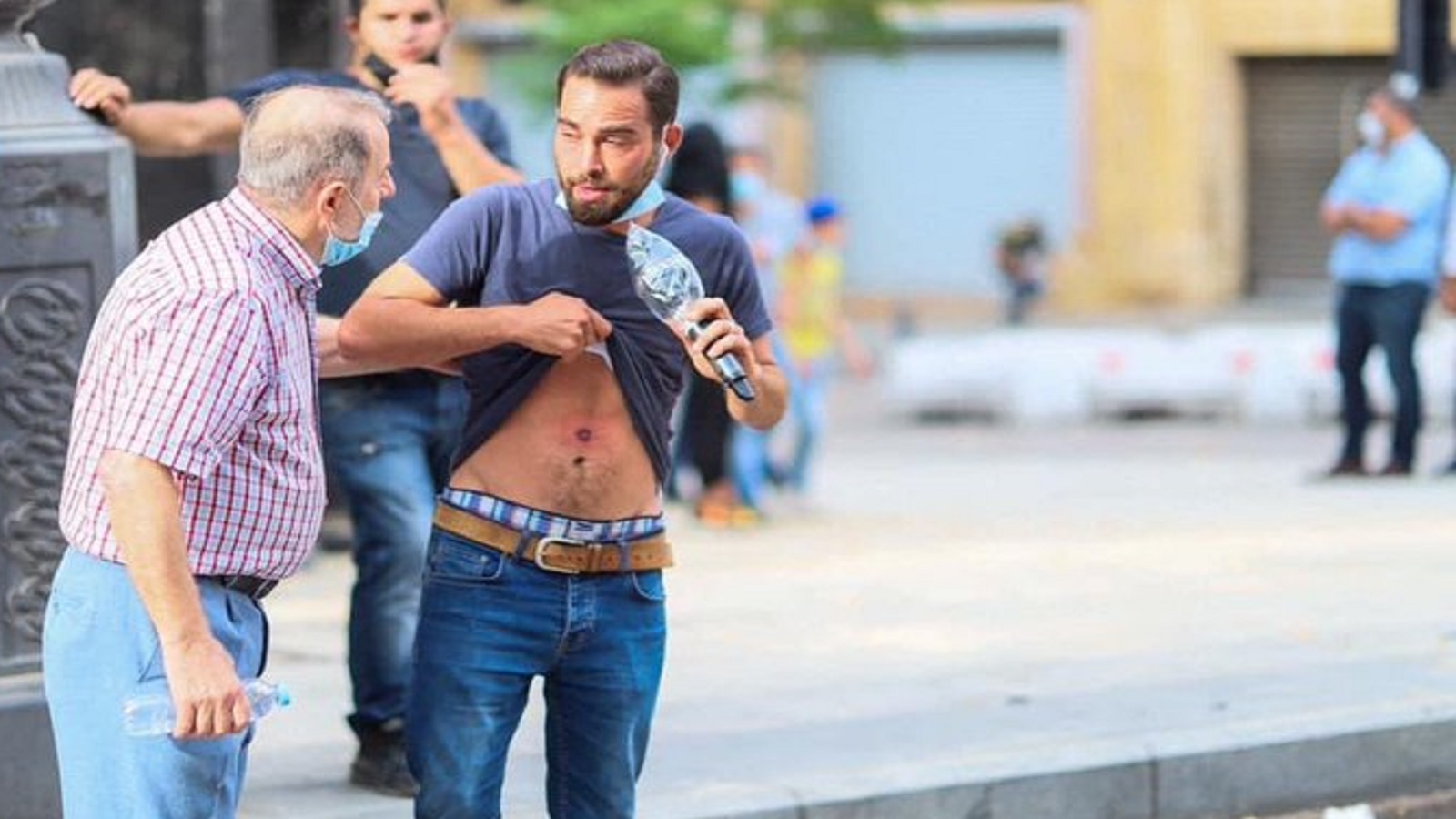 اعتداءان على الصحافيين..والرفاعي يكمل رسالته بعد اصابته بالرصاص المطاطي